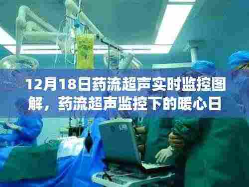 药流超声实时监控下的温馨时光，暖心日常与友共度时刻