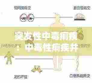 突发性中毒痢疾:中毒性痢疾并发症