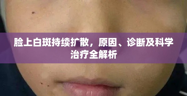 脸上白斑持续扩散,原因、诊断及科学治疗全解析