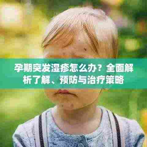孕期突发湿疹怎么办？全面解析了解、预防与治疗策略